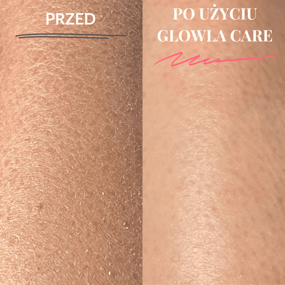Glowla Care - Rękawica Do Peelingu Ciała