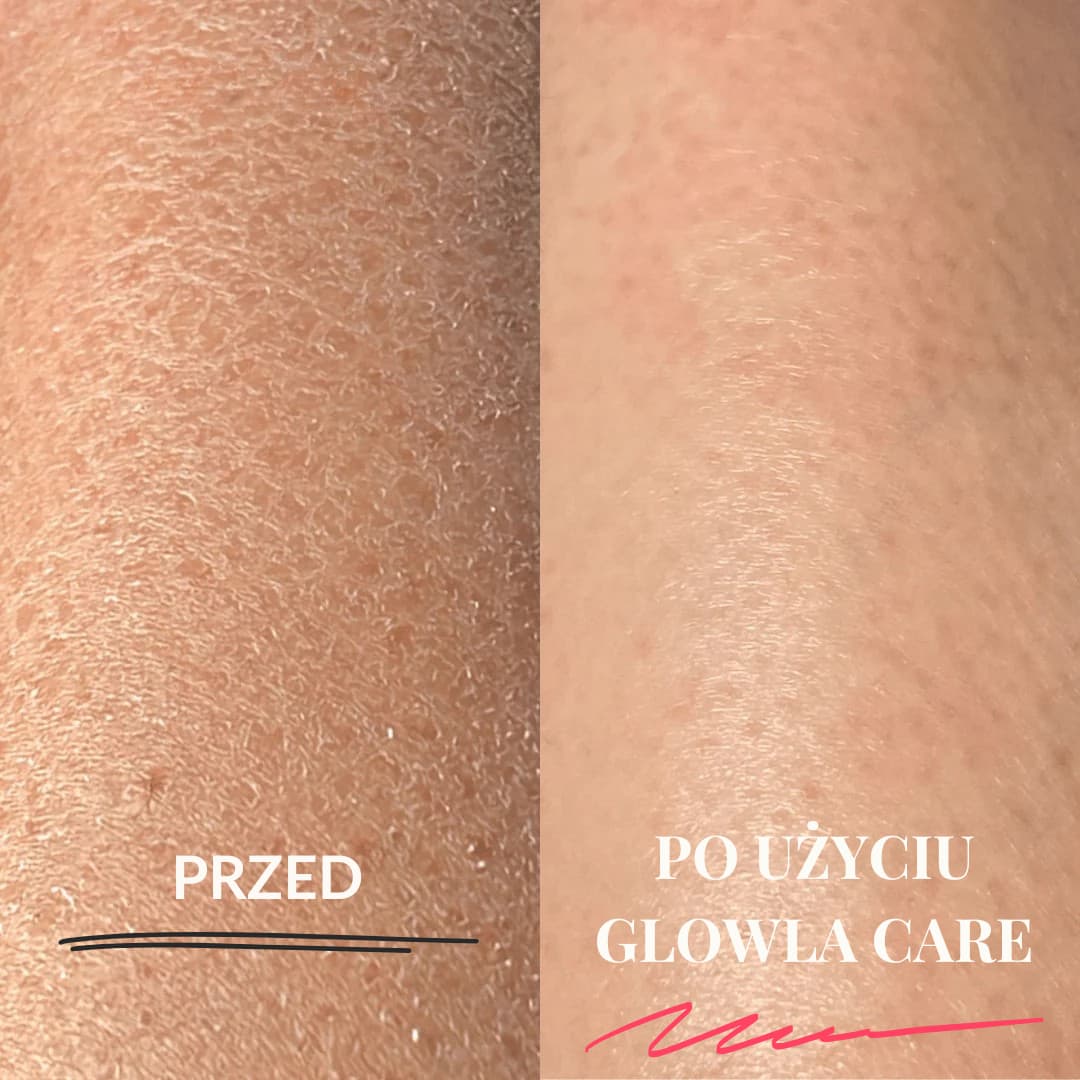 Glowla Care - Rękawica Do Peelingu Ciała