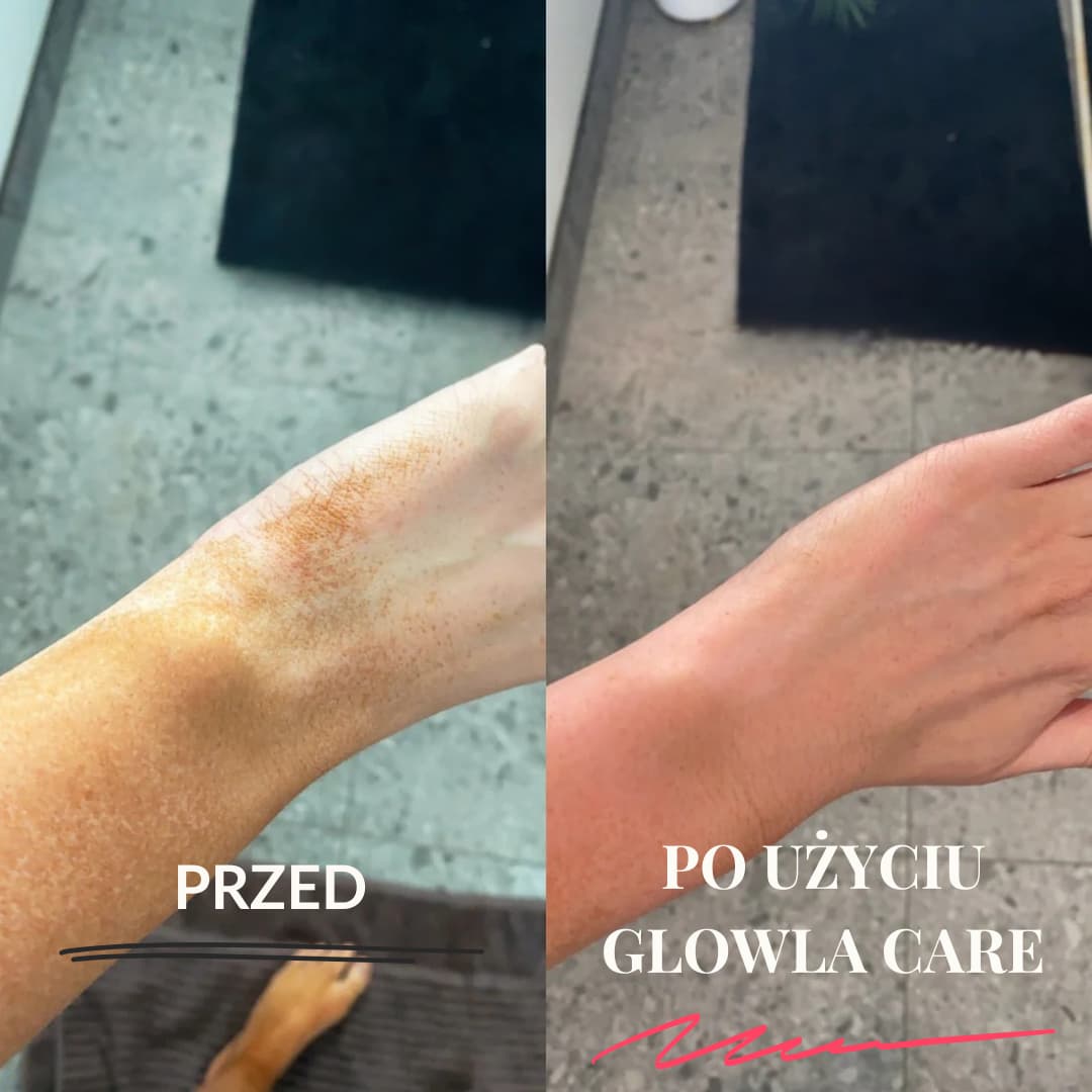 Glowla Care - Rękawica Do Peelingu Ciała